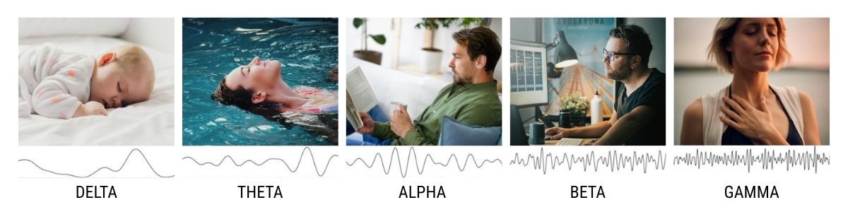 what frequencies does neuroptimal work in neurofeedback rental